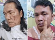 Warga Sinaksak Laporkan Oknum Diduga Panitera PN Pematangsiantar ke Polisi atas Dugaan Penganiayaan