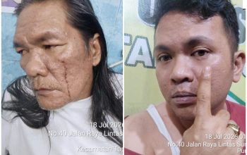 Warga Sinaksak Laporkan Oknum Diduga Panitera PN Pematangsiantar ke Polisi atas Dugaan Penganiayaan