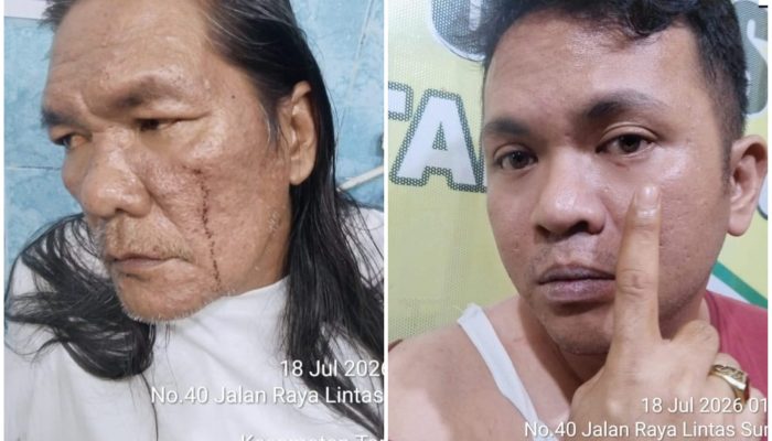 Warga Sinaksak Laporkan Oknum Diduga Panitera PN Pematangsiantar ke Polisi atas Dugaan Penganiayaan